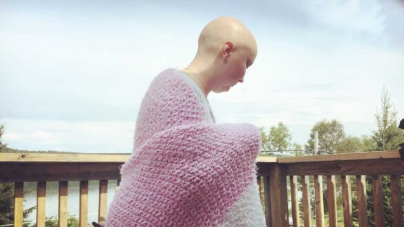 A bald young woman with a pink blanket around her